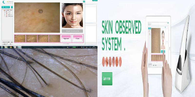 handheld skin analyzer