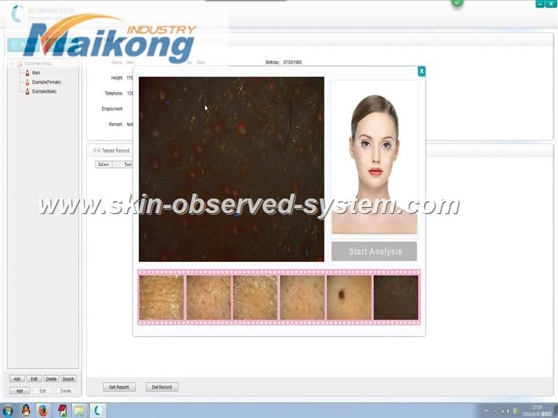 how to use the Skin Observed System (10)