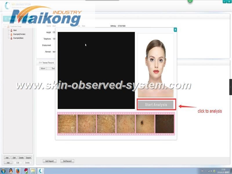 how to use the Skin Observed System (11)