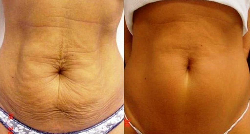 How To Tighten Your Skin Naturally. • FaithPanda