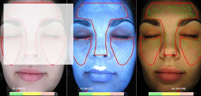 Skin Analyzer App Skin Analyzer Skin Analyzer Hair Analyzer Hair Diagnosis Dental Intraoral Cameras Iriscope