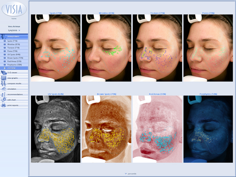Skin Analysis Machine Color Chart