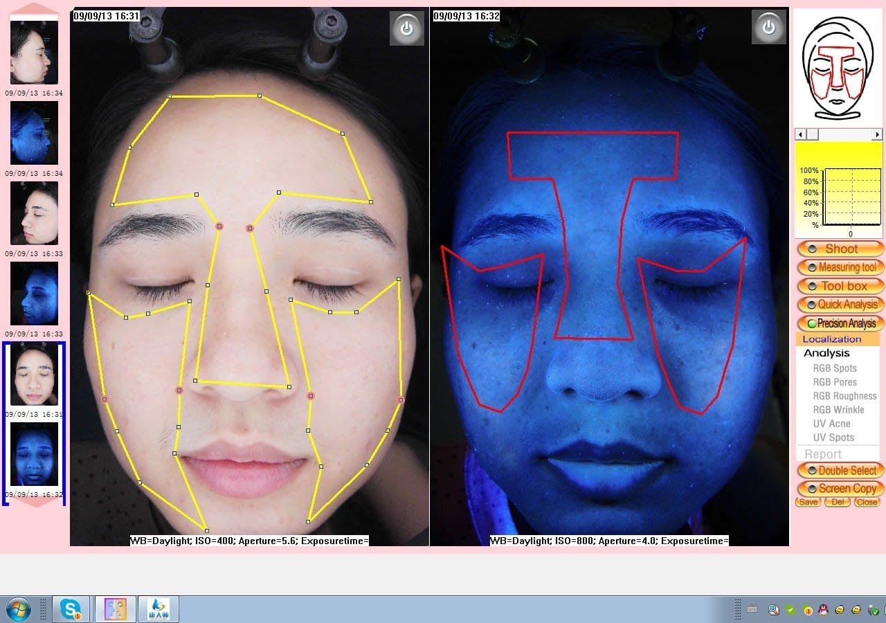 skin analysis