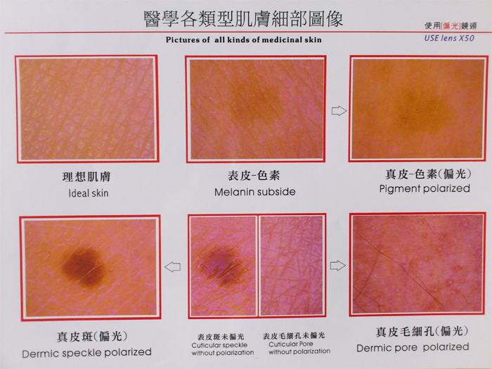 Skin Scanner Color Chart