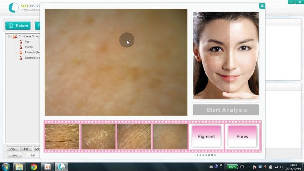 skin analyzer machine manufacturers