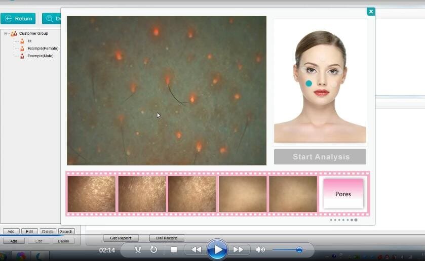 skin analyzer machine sam