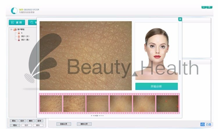 proderm skin analyzer
