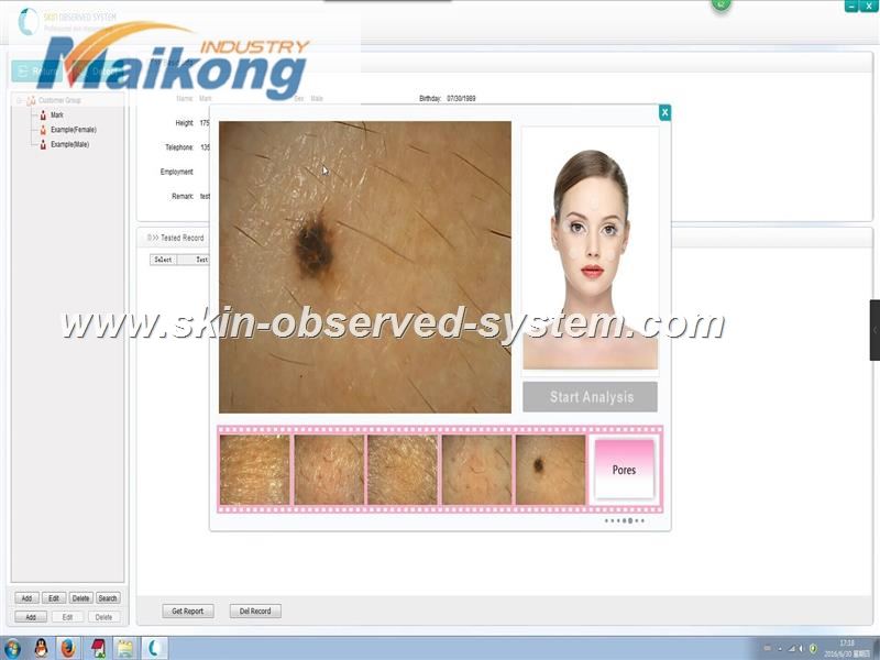 how to use the Skin Observed System (9)