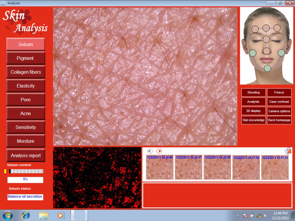 skin analyzer software download