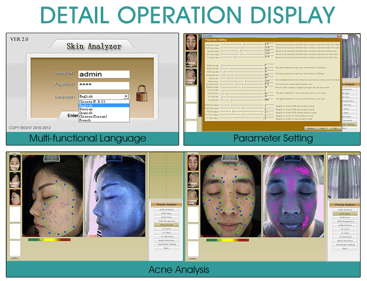 facial skin analyzer