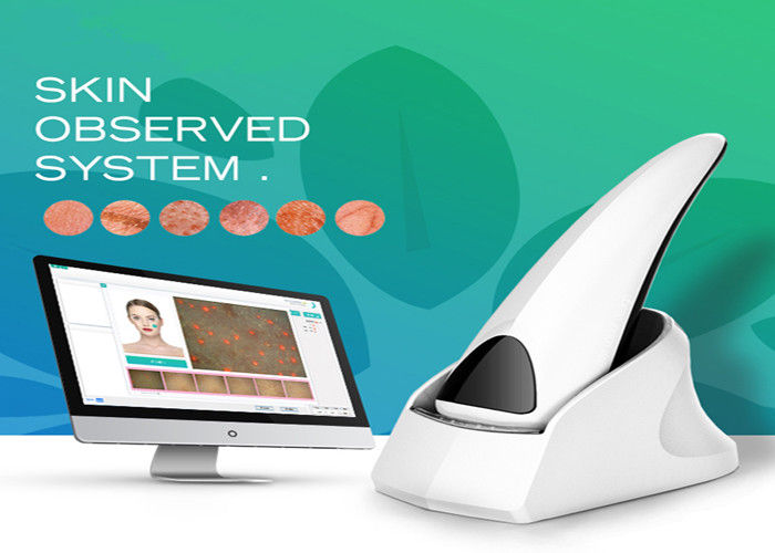 skin observed system download