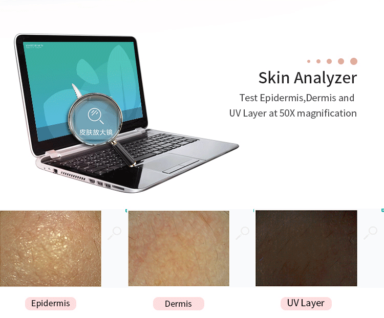 Portable skin analysis device