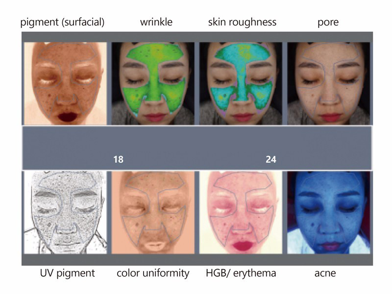 7 point skin analysis