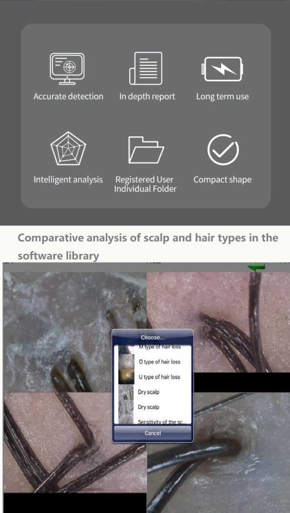 Maikong Skin Analyzer for Android OS